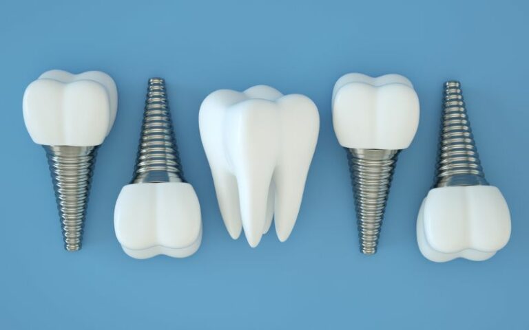 dental implants on a blue background