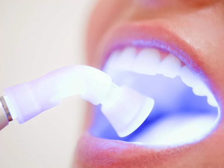 Image of a dentist using a Waterlase laser system on a patient.