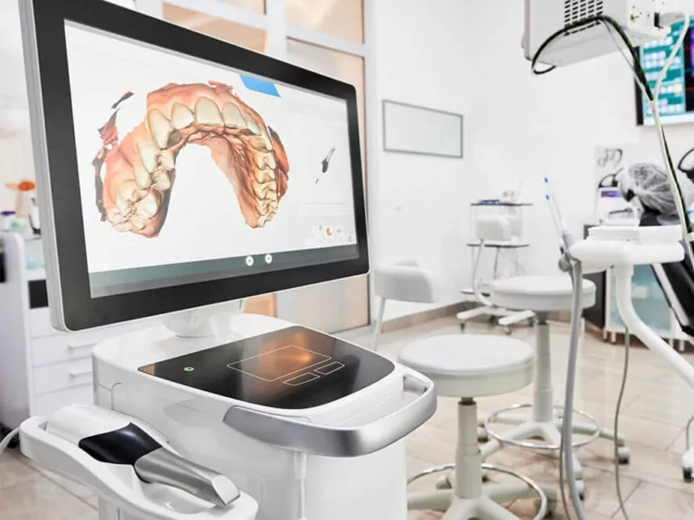 Image of a CEREC scan with a a patients teeth displayed